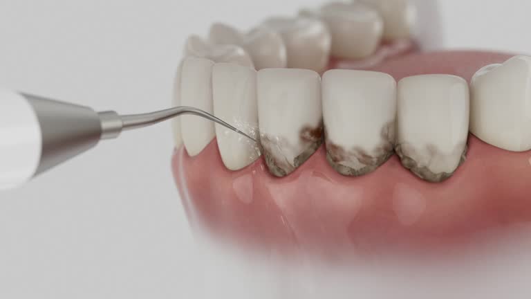 Reliable Emergency Dentist contractor in Malta, MT by Smile Center Dentistry